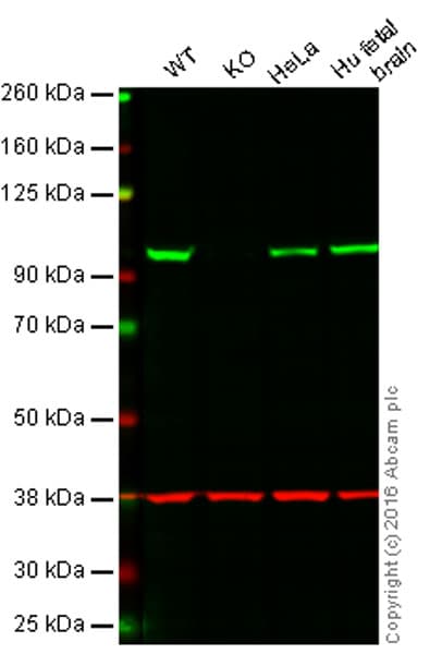 Gamma Adaptin Antibody Epr9875b Bsa And Azide Free Ab249398  Western Blot Img106281