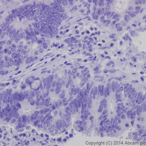 Anti-Insulin antibody [EPR17359](AB181547)