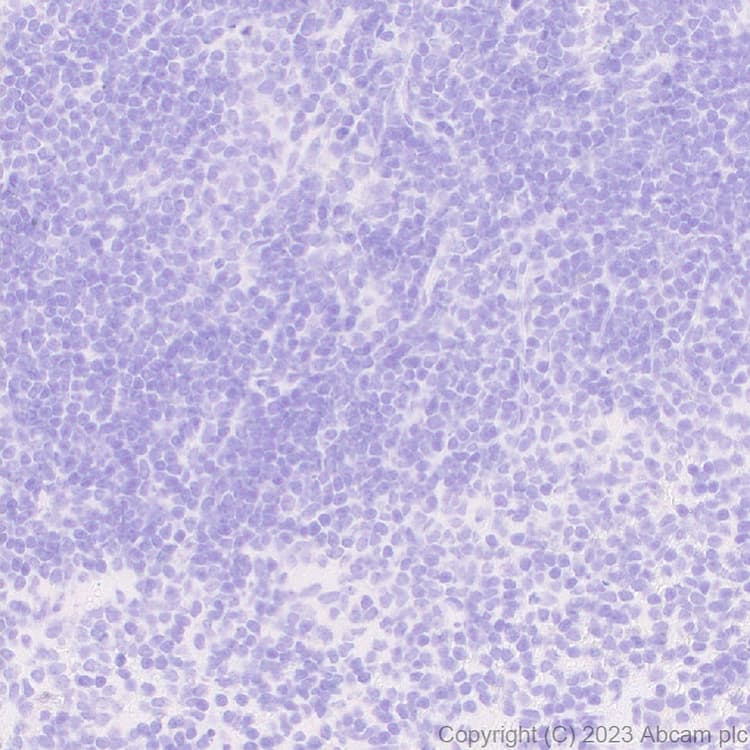 Anti-Homeobox protein cut-like 2 antibody [EPR26509-79](AB315796)