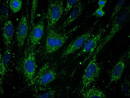 Anti-Frataxin antibody [17A11](AB113691)