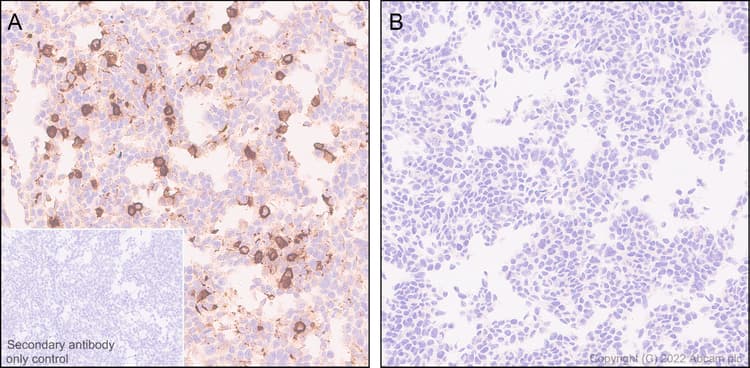 Anti-TMEM119 antibody [RM1075] - BSA and Azide free(AB314915)