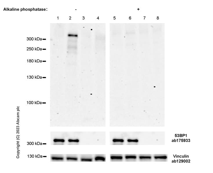 Anti-53BP1 antibody [EPR2172(2)](AB175933)