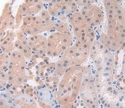 Anti-ACD antibody(AB231330)