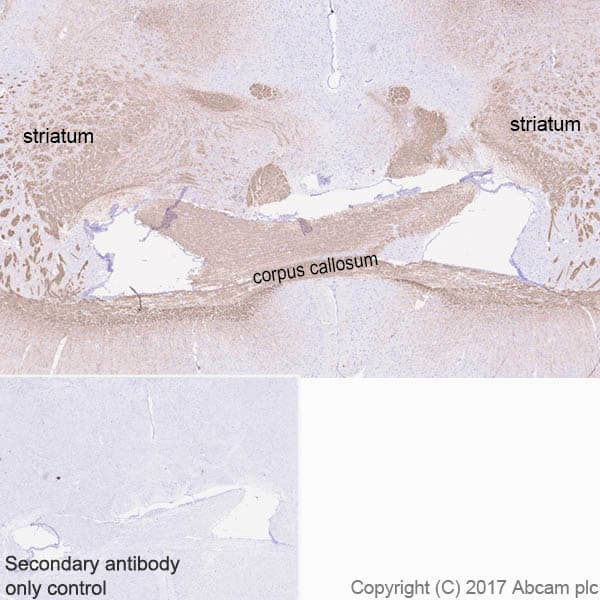 Anti-Myelin Basic Protein antibody [EPR21188](AB218011)