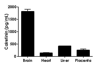 Calretinin ELISA Kit(AB233616)