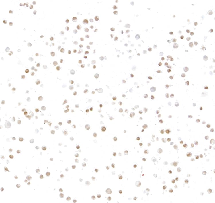 Anti-ASCL1/MASH1 antibody [BLR164J] - BSA free(AB314100)