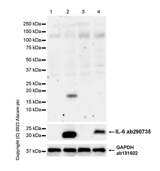 Anti-IL-6 antibody [EPR23819-103](AB290735)