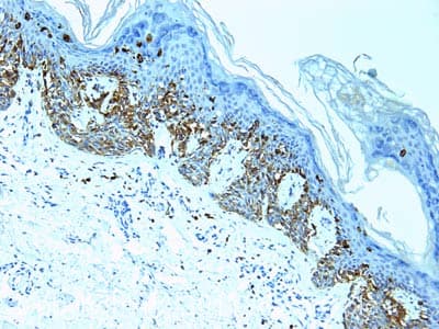 Anti-Melanoma antibody [HMB45 + M2-7C10 + M2-9E3 + T311](AB733)