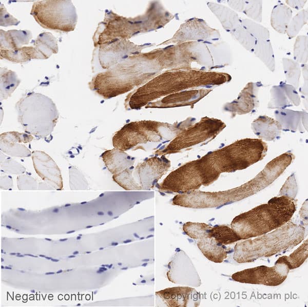 Biotin Desmin Antibody Y66 Cytoskeleton Marker Ab197603  Immunohistochemistry Formalin Pfa Fixed Paraffin Embedded Sections Img76528