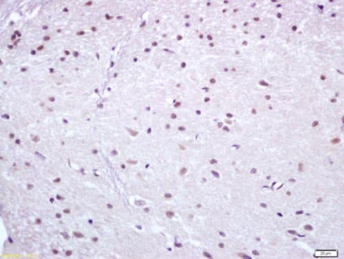 Anti-NUR77 antibody(AB217547)