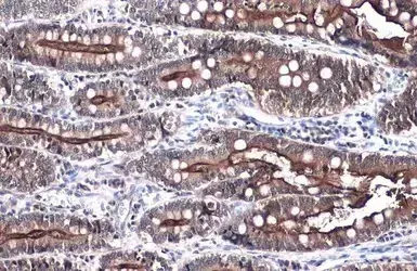 Anti-Villin antibody(AB97512)