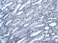 Tls Fus Antibody Epr5812 Ab124923  Immunohistochemistry Formalin Pfa Fixed Paraffin Embedded Sections Img112682