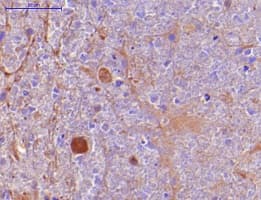 Anti-TNF alpha antibody [P/T2](AB9579)