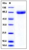 Recombinant Mouse Acetylcholinesterase protein (His tag)(ab276869)