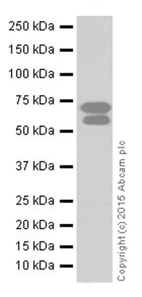 Bace1 Antibody Epr19523 Ab183612  Western Blot Img83292