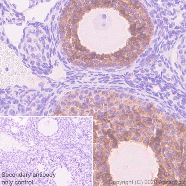 Anti-AMH antibody [EPR23380-171](AB272221)