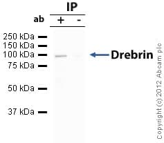 Anti-Drebrin antibody(AB60933)