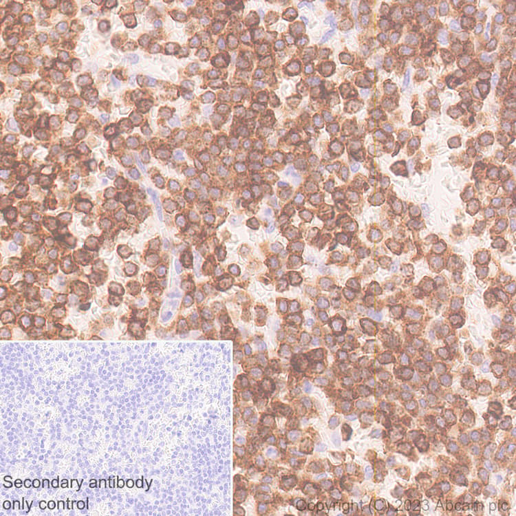 Cd96 Antibody Epr26489 23 Bsa And Azide Free Ab315219  Immunohistochemistry Formalin Pfa Fixed Paraffin Embedded Sections Img424256