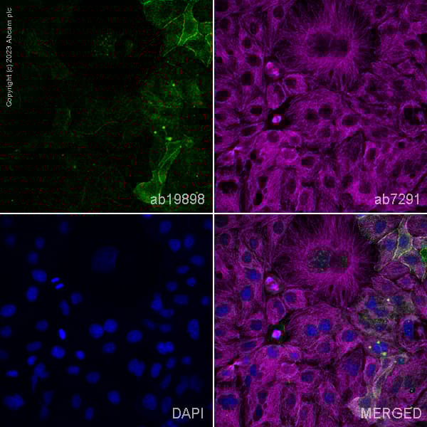 Anti-CD133 antibody - Stem Cell Marker(AB19898)