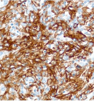 Cd16 Antibody Sp175 Ab183354  Immunohistochemistry Formalin Pfa Fixed Paraffin Embedded Sections Img83507