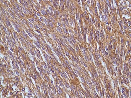 Anti-TMEM16A antibody [SP31](ab64085)