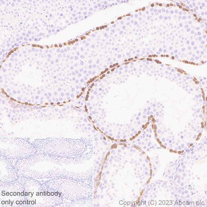 Anti-Stra8 antibody [EPR27083-56](AB308124)