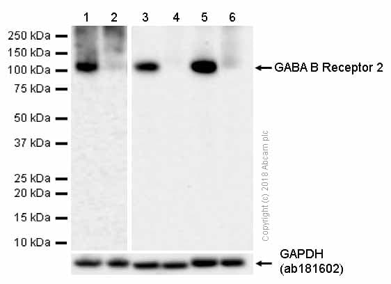 Anti-GabA B Receptor 2/GabBR2 antibody [EP2411Y](ab75838)