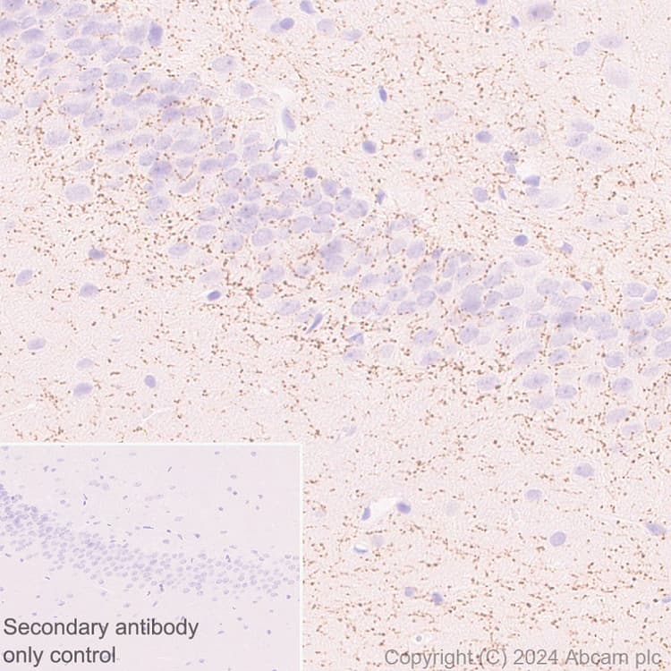 Anti-VAChT antibody [EPR29154-71](AB317452)