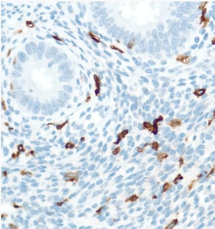 Cd16 Antibody Sp175 Ab183354  Immunohistochemistry Formalin Pfa Fixed Paraffin Embedded Sections Img20553