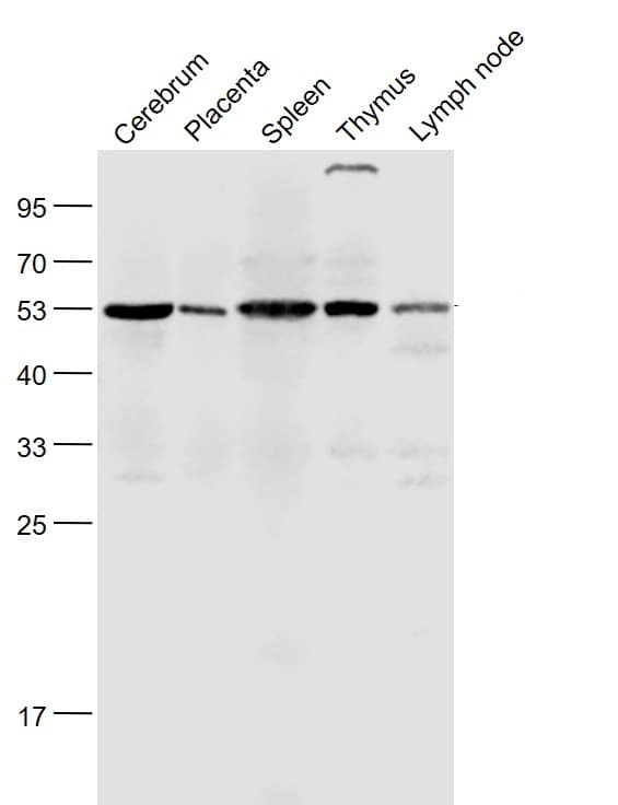 Anti-Nicotinic Acetylcholine Receptor alpha 7 antibody(AB216485)