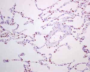 Anti-TTF1/Nkx2-1 antibody [EPR8190-138] - BSA and Azide free(AB227576)