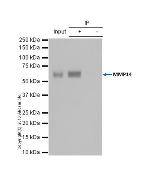 Anti-MMP14 antibody [EP1264Y](AB51074)
