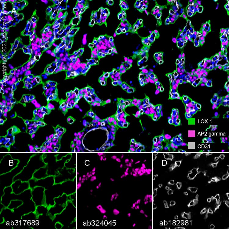 Lox 1 Antibody Epr27871 67 Bsa And Azide Free Ab317690  Multiplex Immunohistochemistry Img450300