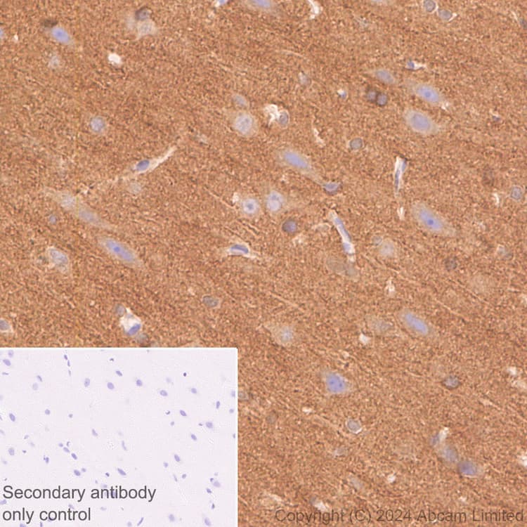 Anti-Tau antibody [EP2456Y](AB76128)