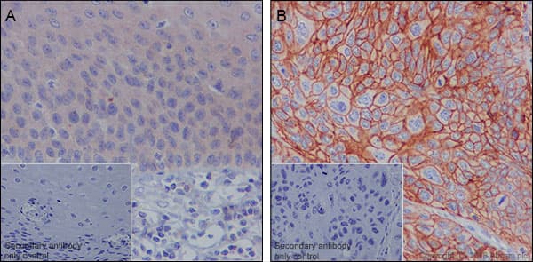 Anti-MRP1 antibody [EPR21062](ab233383)