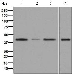 Mvk Antibody Epr6507 Ab126619  Western Blot Img116436