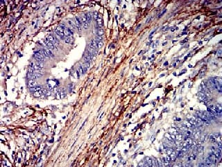 Anti-PAR1/Thrombin Receptor antibody [5E2E6](AB233741)