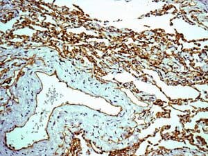 Anti-Claudin 5 antibody [EPR7583](AB131259)