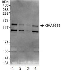 Kiaa1688 Antibody Ab93780  Western Blot Img48859