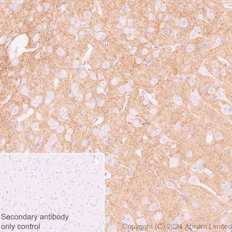 Pmca2 Antibody Epr28923 56 Bsa And Azide Free Ab319151  Immunohistochemistry Formalin Pfa Fixed Paraffin Embedded Sections Img435218