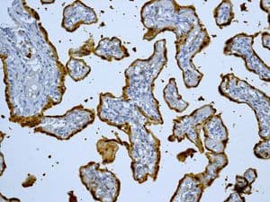 Anti-S100P antibody [EPR6142](AB124743)