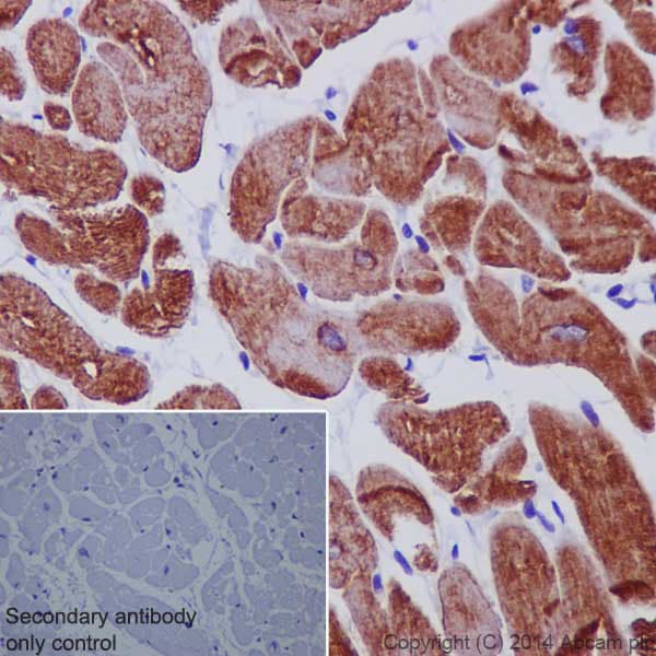 Anti-Desmin antibody - Cytoskeleton Marker(AB15200)
