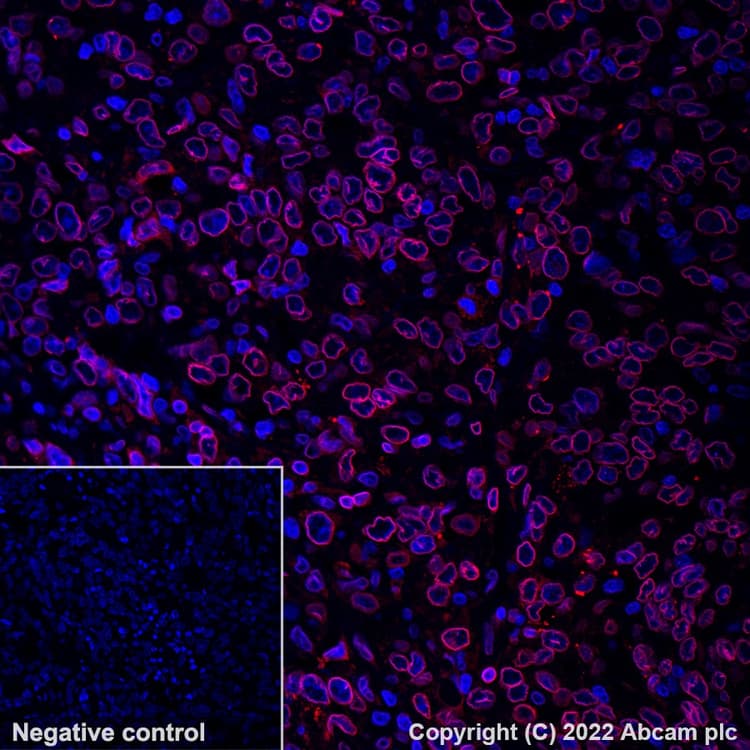 Alexa Fluor® 647 Anti-Lamin B2 antibody [EPR9701(B)](AB200427)