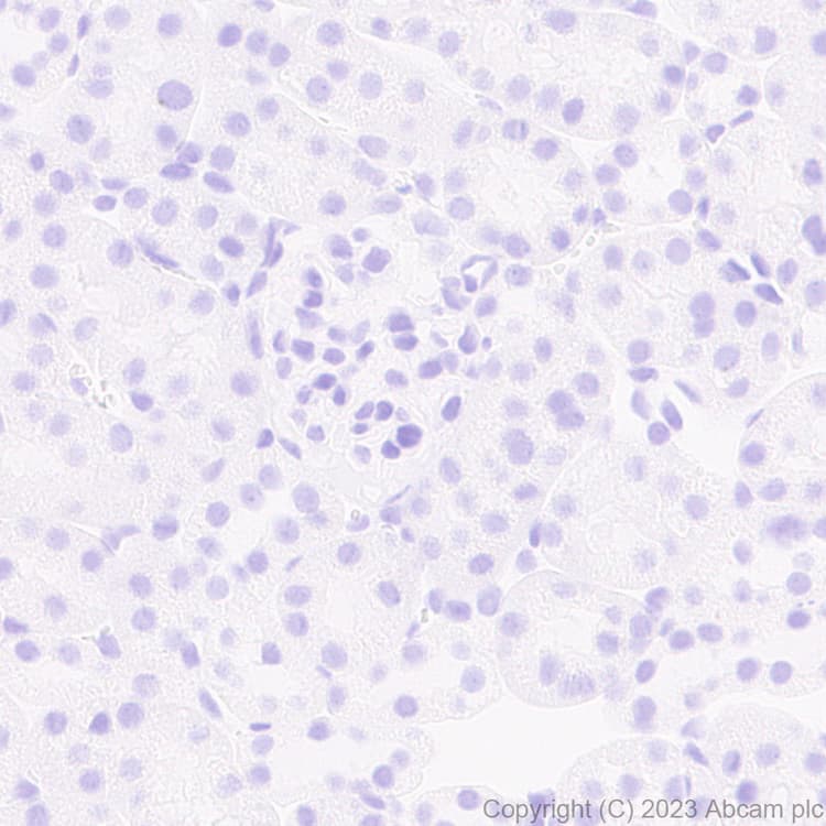 Anti-RS1 antibody [EPR28513-78](AB314231)