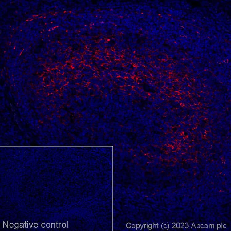 Alexa Fluor 647 Cxcl13 Antibody Epr23400 92 Ab314944  Immunohistochemistry Formalin Pfa Fixed Paraffin Embedded Sections Img423932