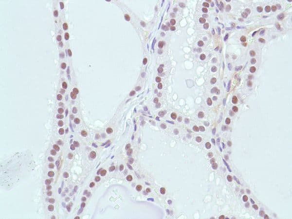 Anti-MSH2 antibody [SP46](AB231437)