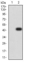 Anti-Ctip2 antibody [1F8G8](AB233713)