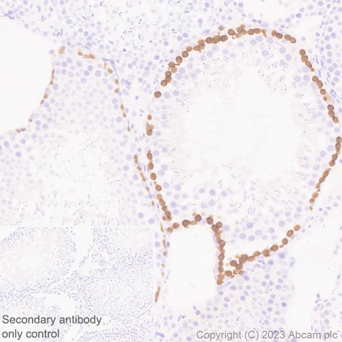 Anti-Stra8 antibody [EPR27083-56](AB308124)
