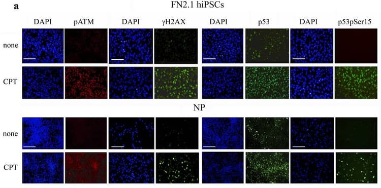 Anti-gamma H2A.X (phospho S139) antibody(AB2893)