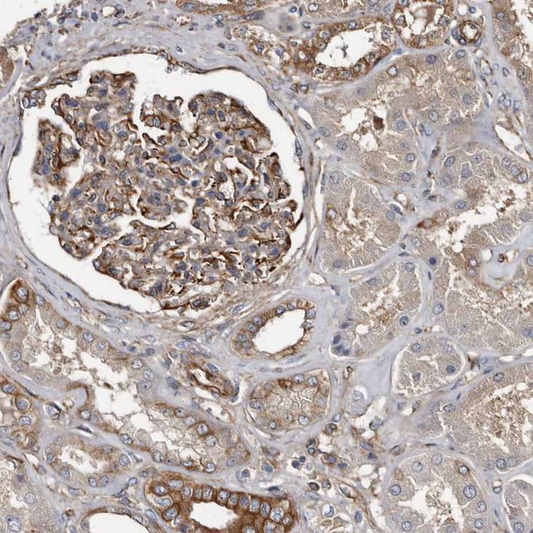 Kctd20 Antibody Ab122094  Immunohistochemistry Formalin Pfa Fixed Paraffin Embedded Sections Img65525